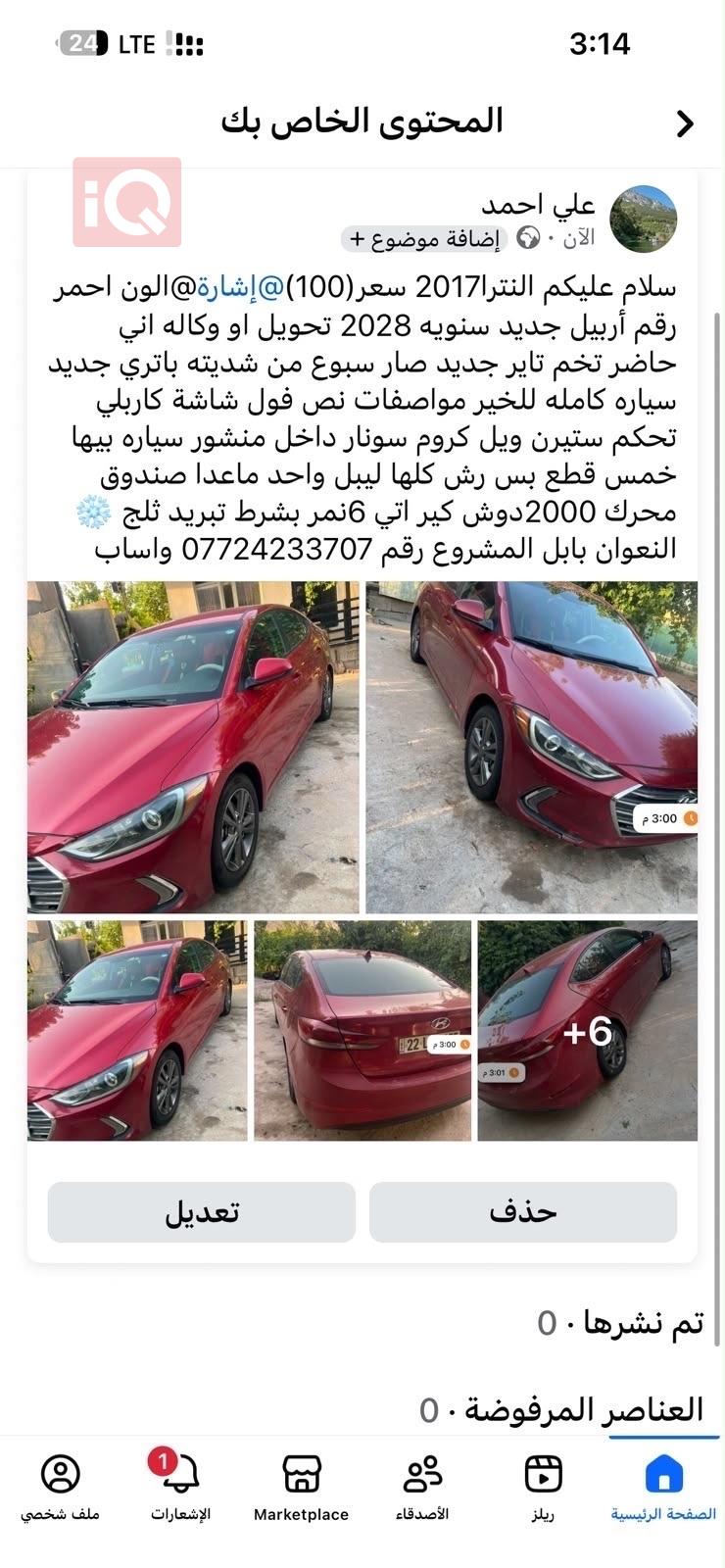 هيونداي النترا